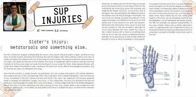Lesiones en el SUP: La lesión de Slater english version